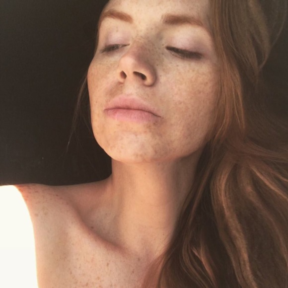 freckledmarvel